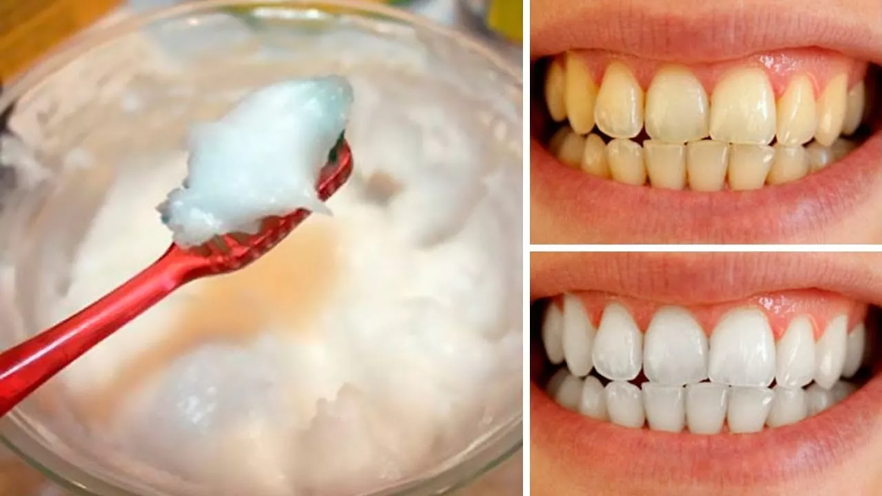 Como Clarear Naturalmente seus Dentes