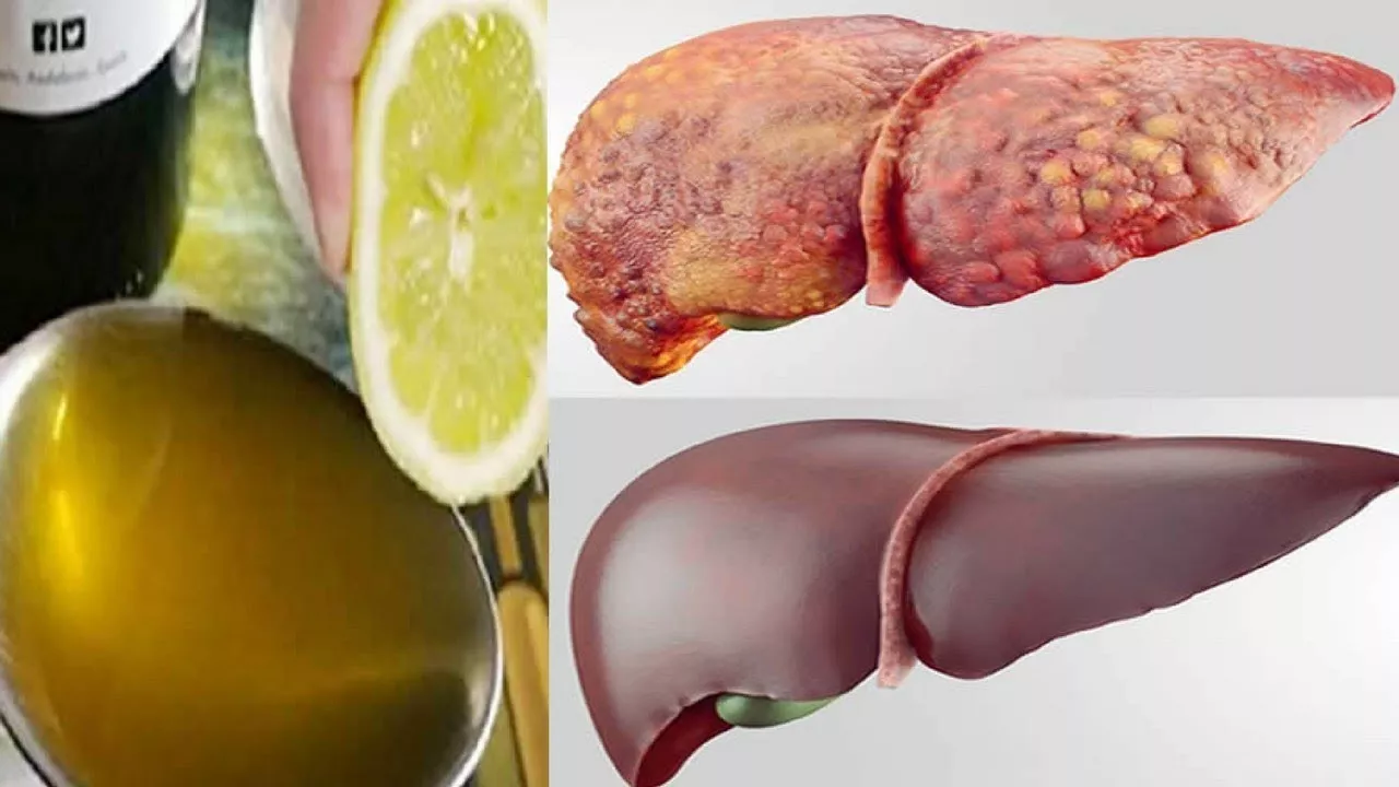 6 Alimentos Para Limpar Naturalmente Seu Fígado